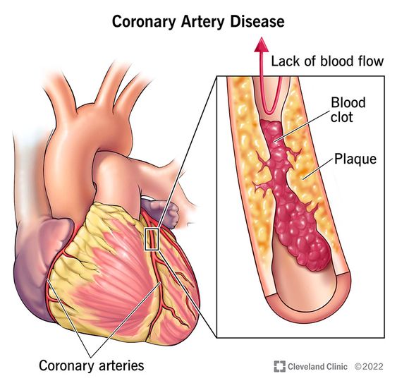 This blog focus about Heart and vascular center, Sanger heart and vascular, Cardio vascular surgeon, Heart and vascular, Heart & vascular.
