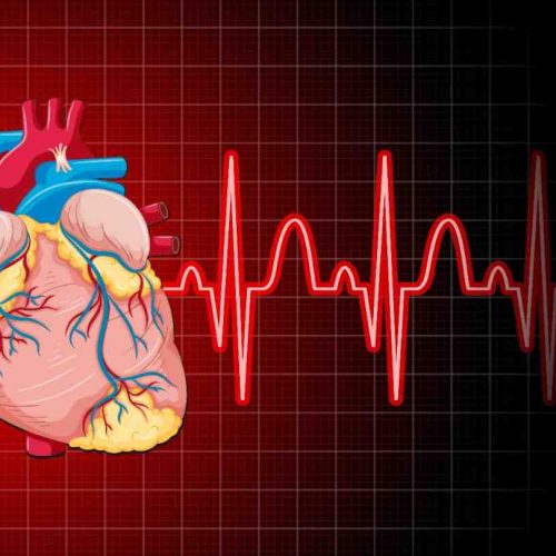 Enjoy the best information Cardiac arrest vs heart attack, Congestive heart failure, Cardiac arrest, Cardiac arrest symptoms, Heart failure.
